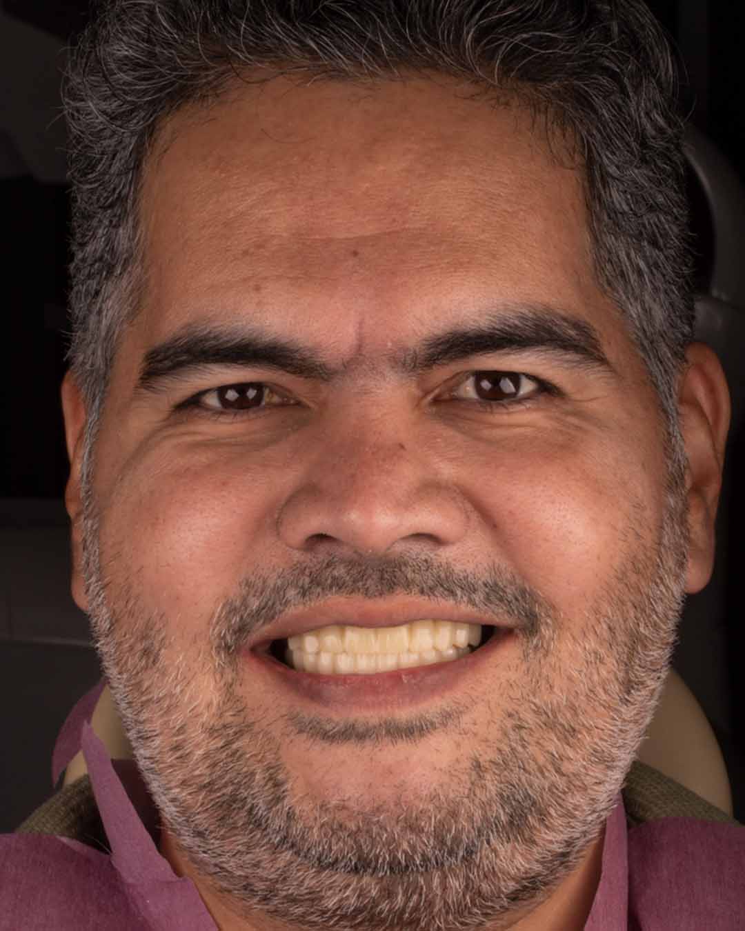 بعد از