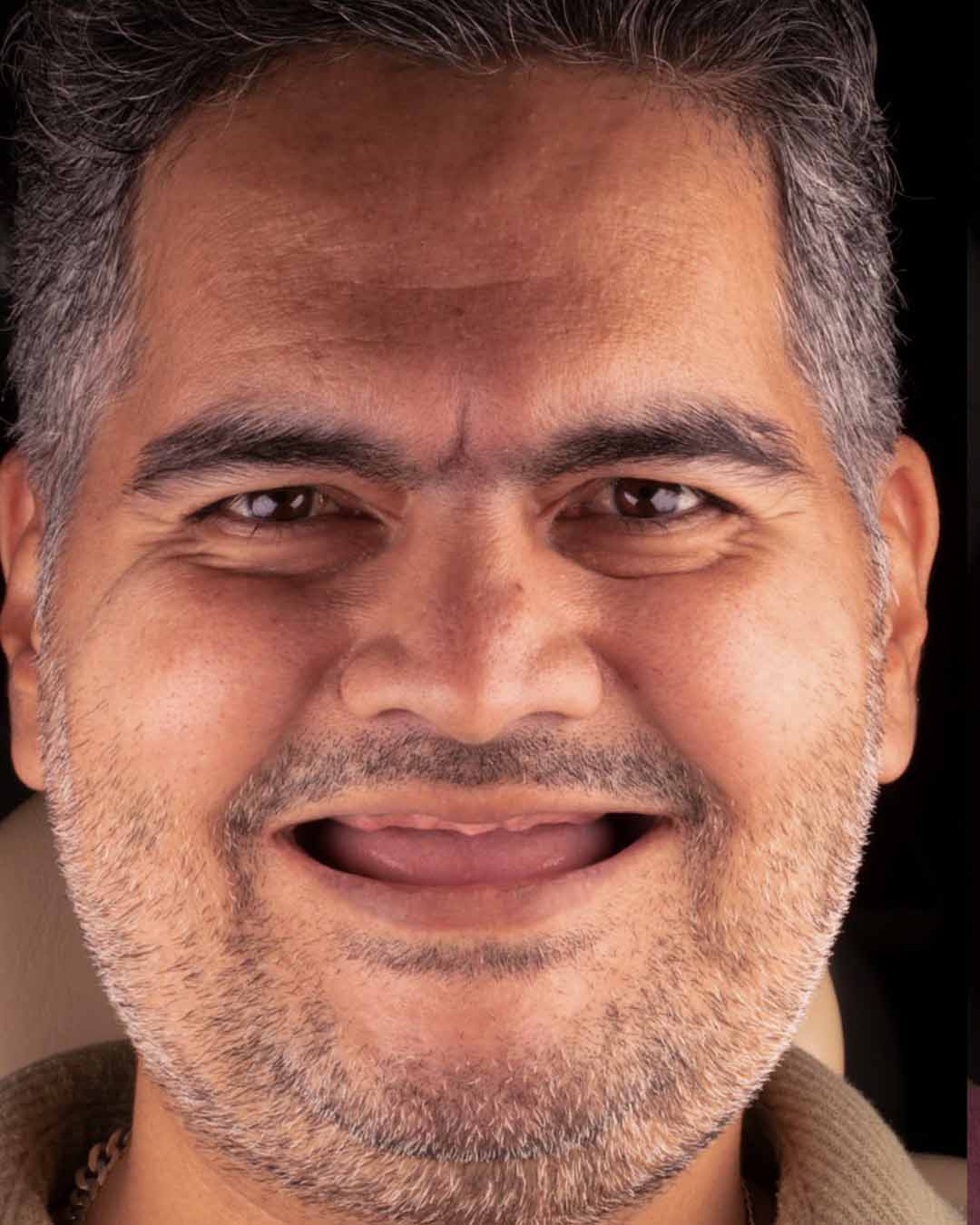 قبل از