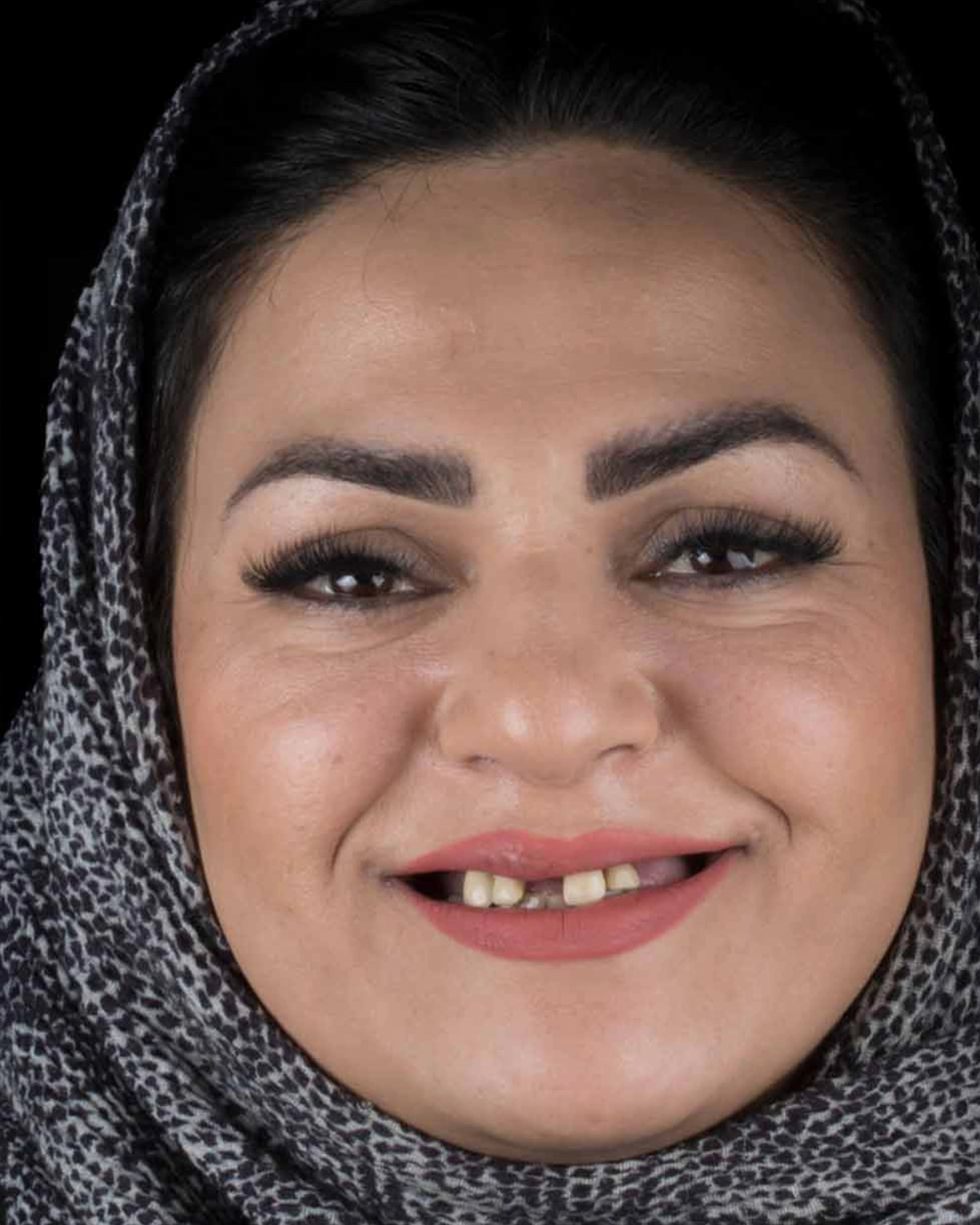 قبل از