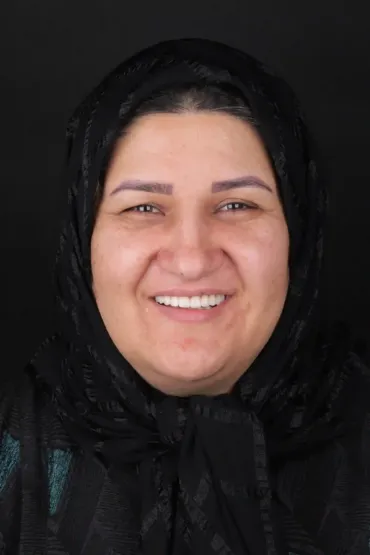 کاشت ایمپلنت فول آرچ - بعد