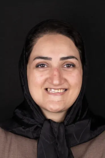 قبل - کاشت ایمپلنت فول آرچ