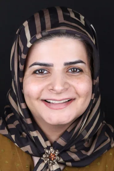کاشت ایمپلنت فول آرچ - بعد