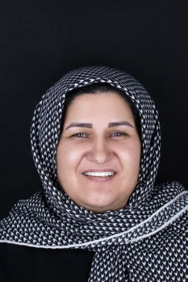 روکش موقت